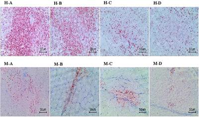 Lipid-Lowering Effects of Lotus Leaf Alcoholic Extract on Serum, Hepatopancreas, and Muscle of Juvenile Grass Carp via Gene Expression